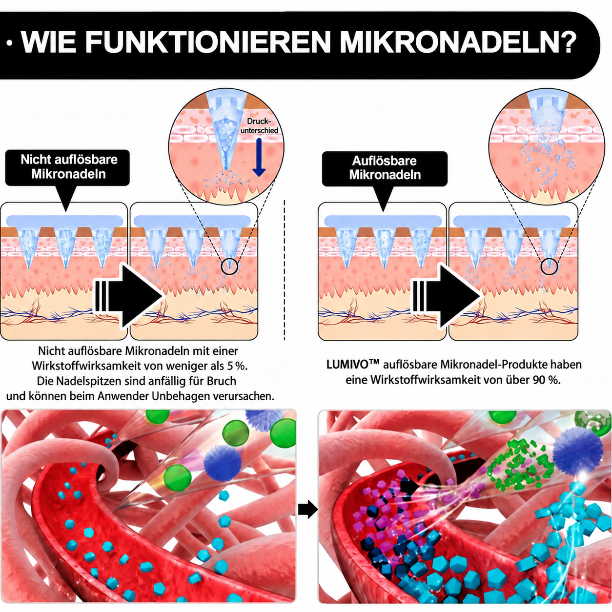 So funktionieren die Mikronadeln